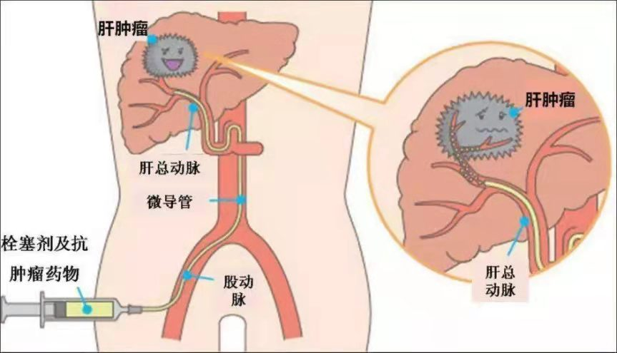 微信图片_20221116093104.png